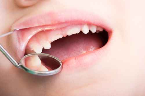 Sussidio alle cure dentarie ortodontiche